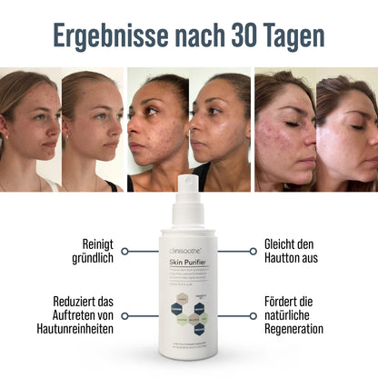Infografik mit Vorher-Nachher-Bildern von drei Frauen, die Ergebnisse nach 30 Tagen Anwendung von Clinisoothe Skin Purifier zeigen. In der Mitte eine Flasche des Produkts, daneben die Vorteile: reinigt gründlich, reduziert Hautunreinheiten, gleicht den Hautton aus, fördert die natürliche Regeneration.