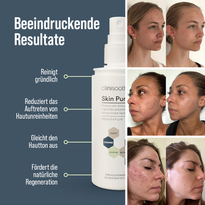 Clinisoothe+ Skin Purifier 100 ml Sprayflasche mit Text „Beeindruckende Resultate“; links vier Produktvorteile (reinigt gründlich, reduziert Hautunreinheiten, gleicht Hautton aus, fördert Regeneration), rechts Vorher-nachher-Fotos von drei Frauen mit sichtbarer Hautverbesserung.